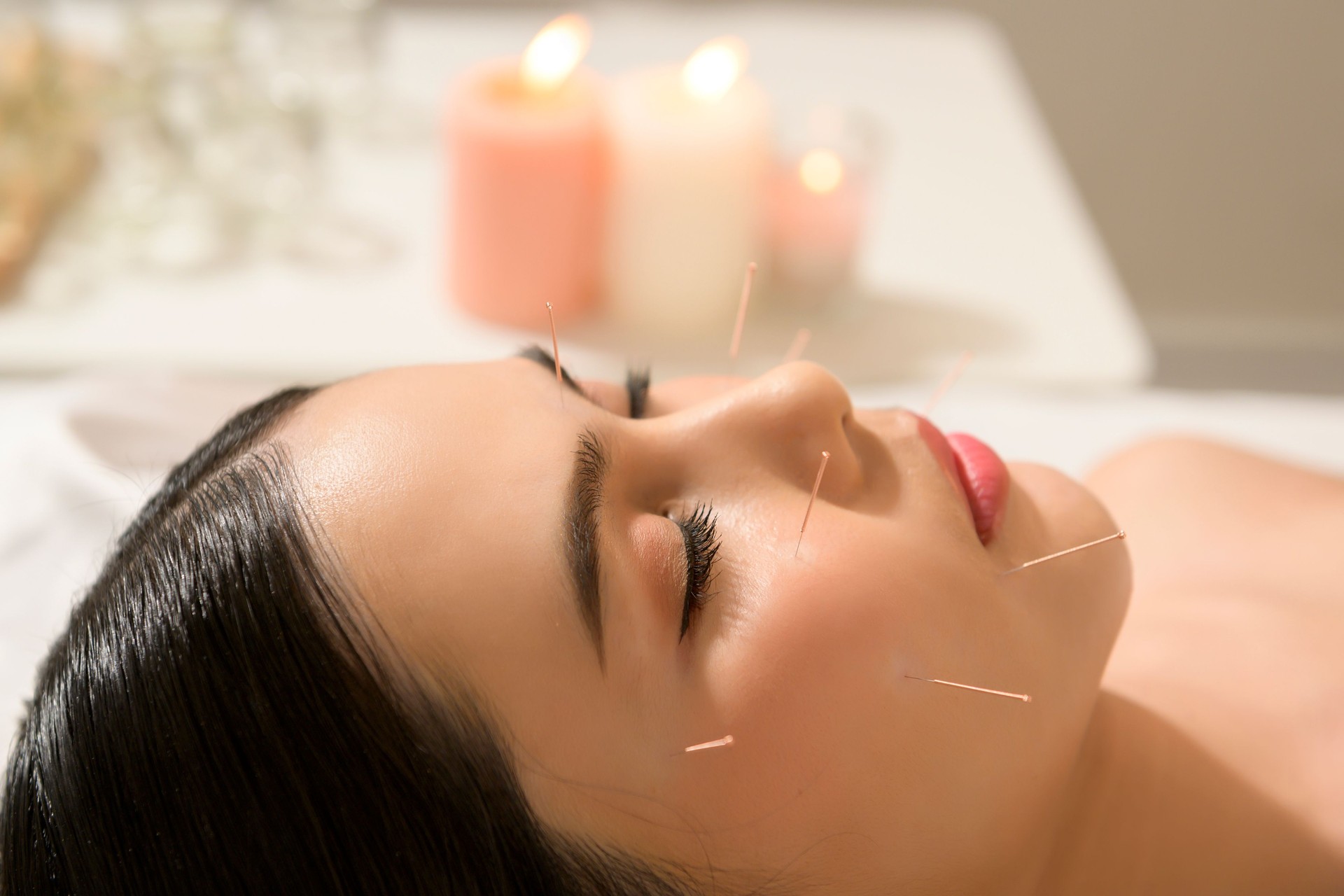Beautiful Woman Received acupuncture treatment on face by  therapist, chinese medicine treatment, health and healing concept.